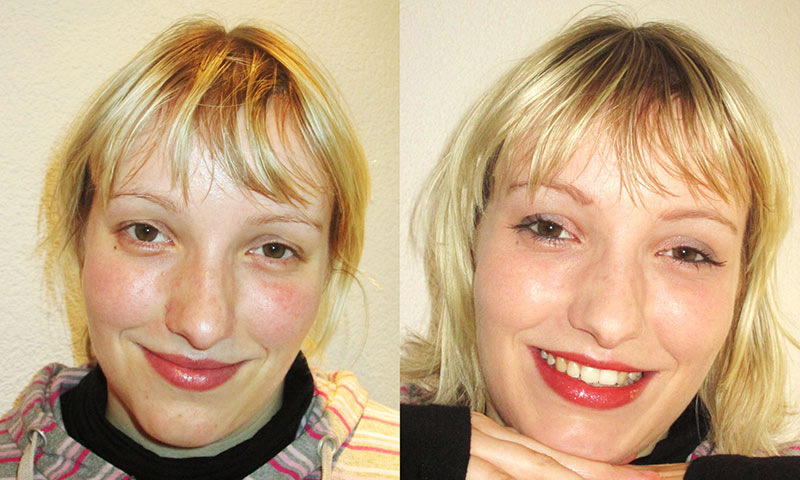 Vorher-Nachher Kosmetikstudio Radeberg Vorher-Nachher Kosmetikstudio Radeberg