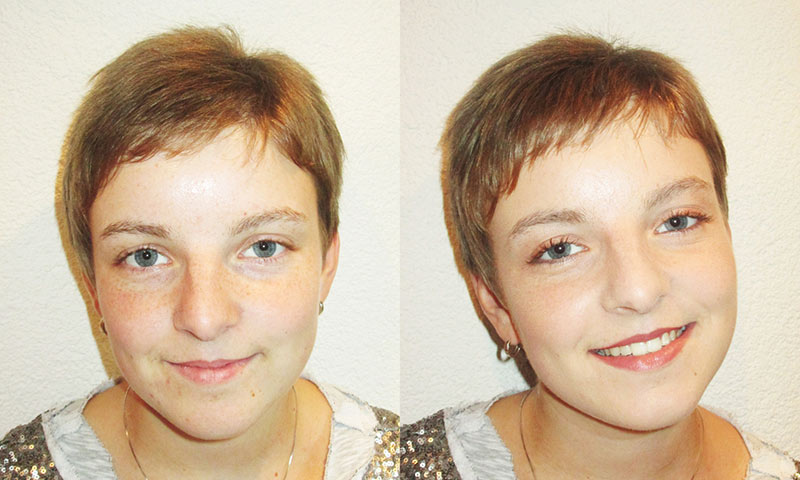 Vorher-Nachher Kosmetikstudio Radeberg Vorher-Nachher Kosmetikstudio Radeberg